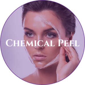 A woman with chemical peel on her face.