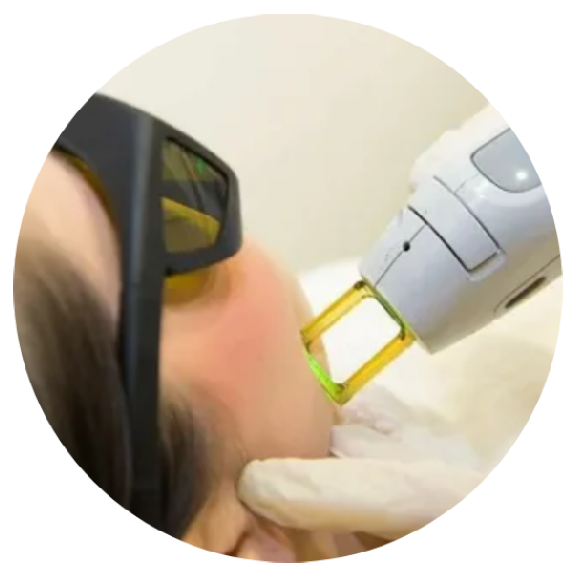 A person is using an electric device to treat a patient 's face.