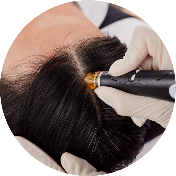 HydraFacial Keravive Scalp Treatment